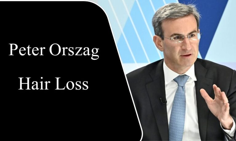 Peter Orszag Hair Loss
