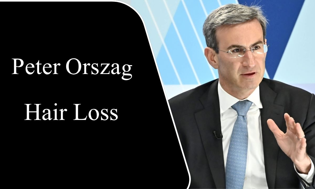 Peter Orszag Hair Loss